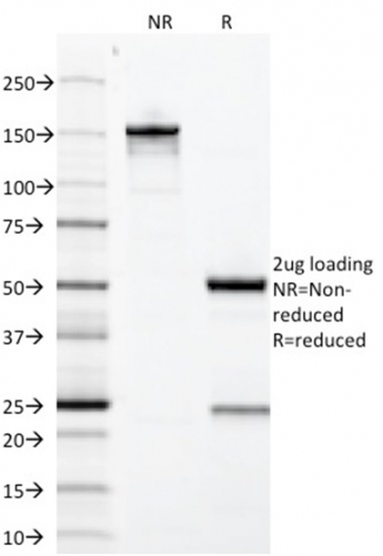 Data from SDS-PAGE analysis of Anti-Growth Hormone antibody (Clone GH/1371). Reducing lane (R) shows heavy and light chain fragments. NR lane shows intact antibody with expected MW of approximately 150 kDa. The data are consistent with a high purity, intact mAb.